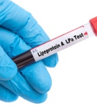 כולסטרול גבוה - תמונת המחשה